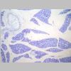 Pancreas SF 01.jpg